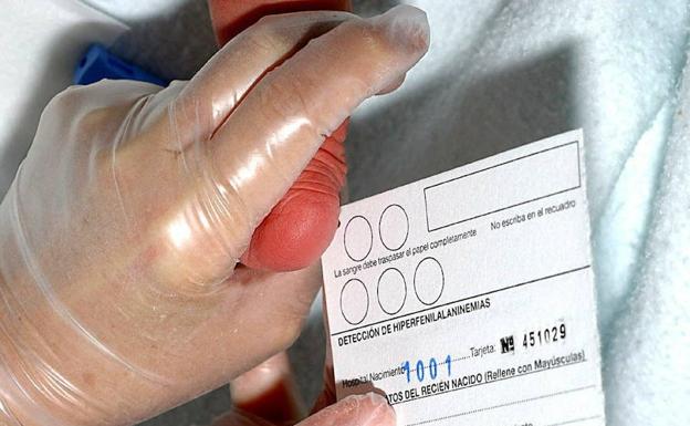 Como se realiza la prueba del talon en recien nacidos Como se realiza la prueba del talon en recien nacidos